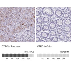 Chymotrypsin C/CTRC Antibody, Novus Biologicals 25ul | Buy Online | Novus Biologicals | Fisher Scientific